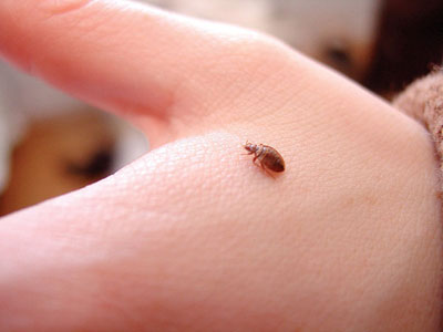 Bed bug on hand